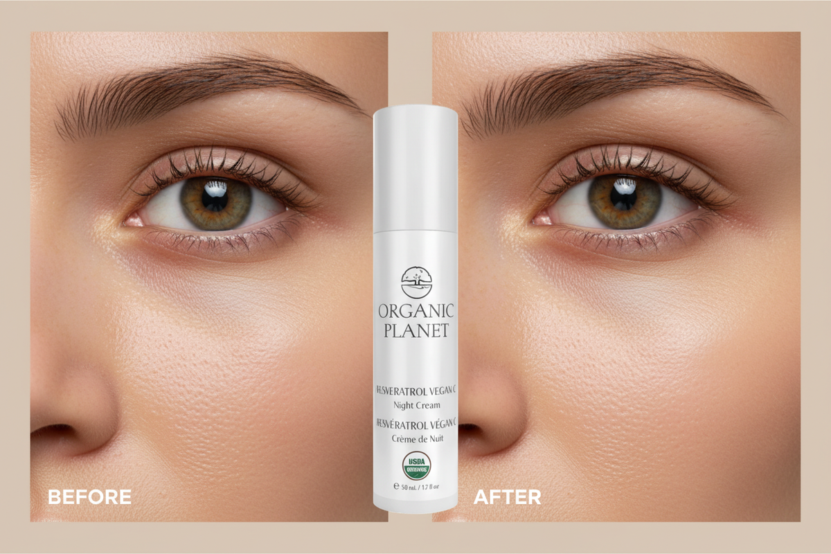 Soft Under-Eye Before & After